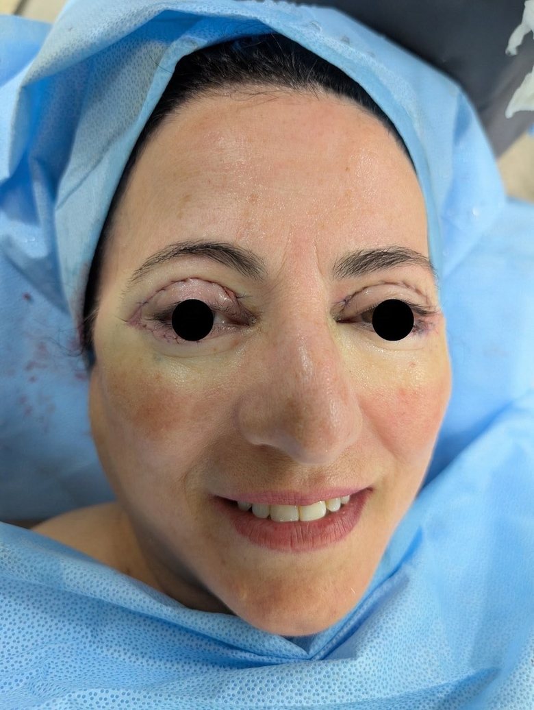 Day of surgery