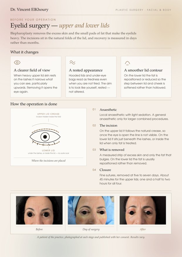 Eyelid surgery information sheet, page one