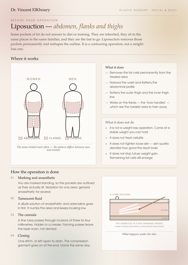Liposuction information sheet, page one