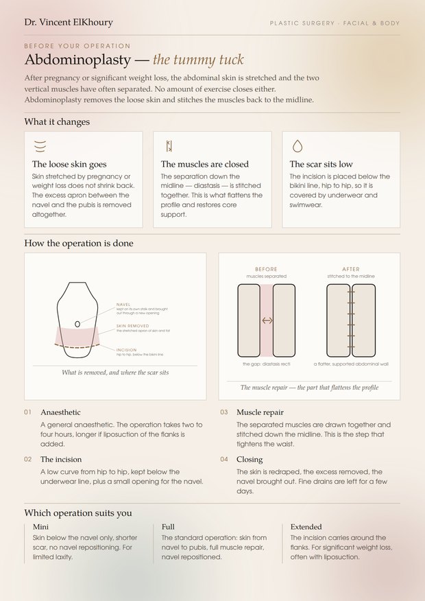 Abdominoplasty information sheet, page one